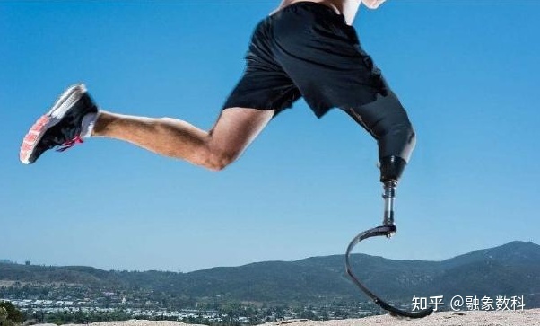 假肢與矯形器制造行業(yè)的未來發(fā)展趨勢